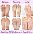 Exfoliating Foot Mask Hydrating Sock Pedicure Essential