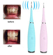 Portable Electric Dental Calculus and Plaque Remover
