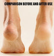 Electronic Pedicure Tool